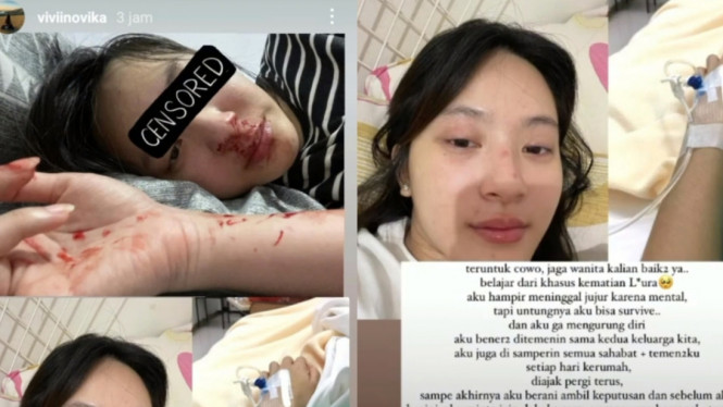 Instagram/viviinovika