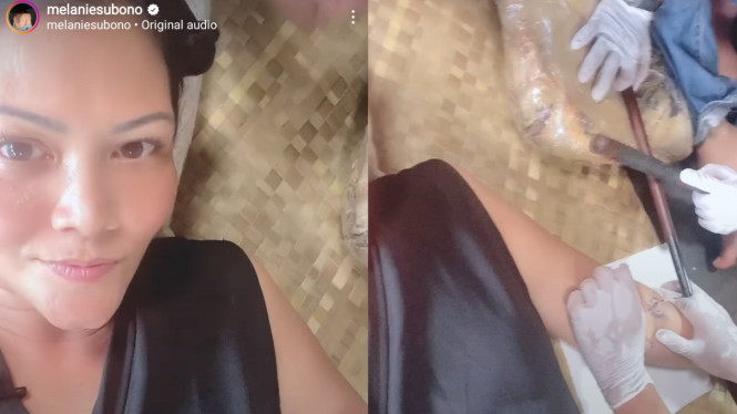 Instagram/melaniesubono