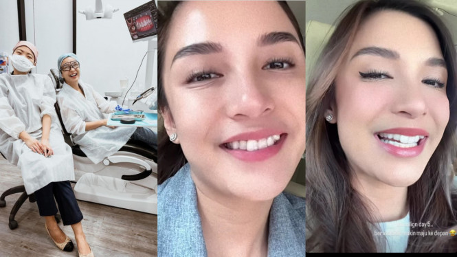 Instagram/@chelseaoliviaa