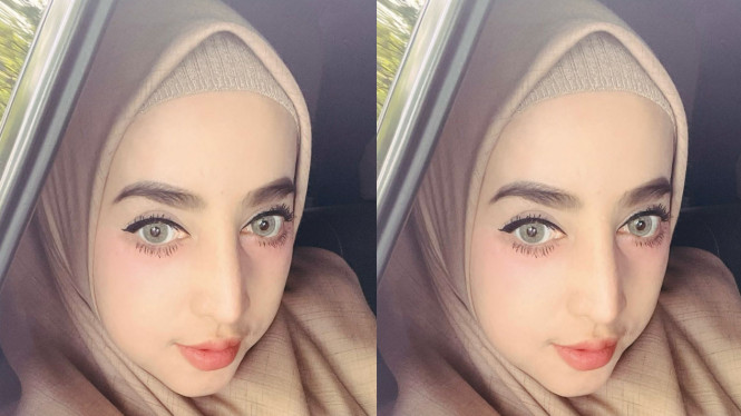 Dokumentasi Istimewa