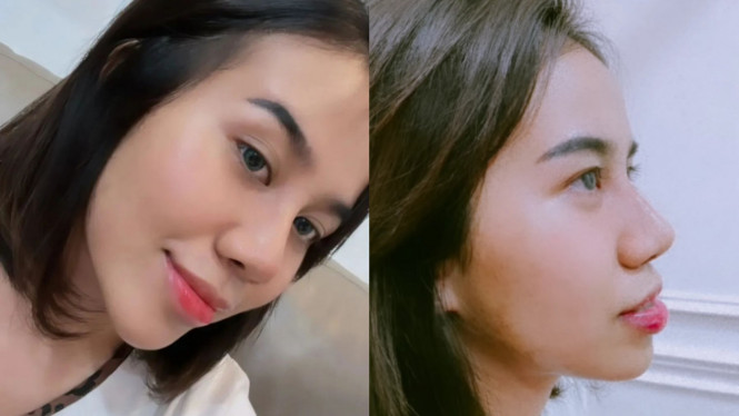 Instagram/dodysoedrajat_1