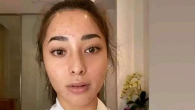 Instagram/@nikitawillyofficial94