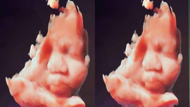 Instagram/zefanyagraneth_ 