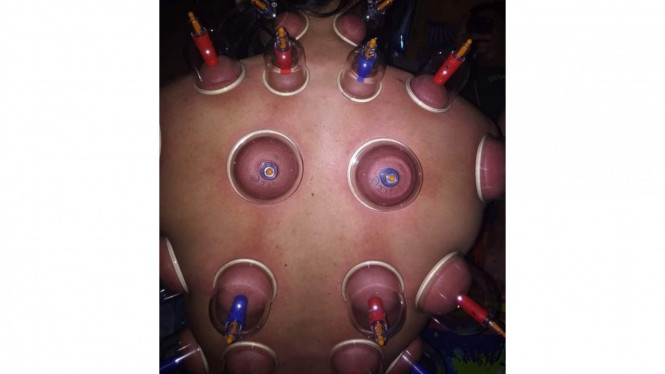 Instagram/@tosyma_pijat