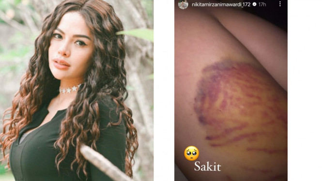 Instagram/@nikitamirzanimawardi_172