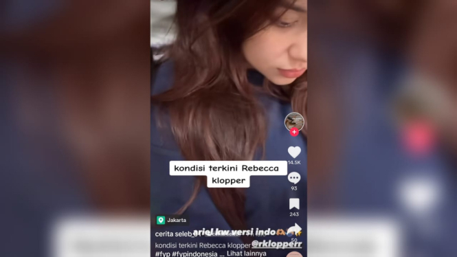 Pasca Vakum dari Instagram, Penampilan Kurus Rebecca Klopper Disorot