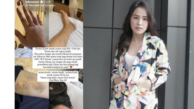 Instagram/@ladynayoan