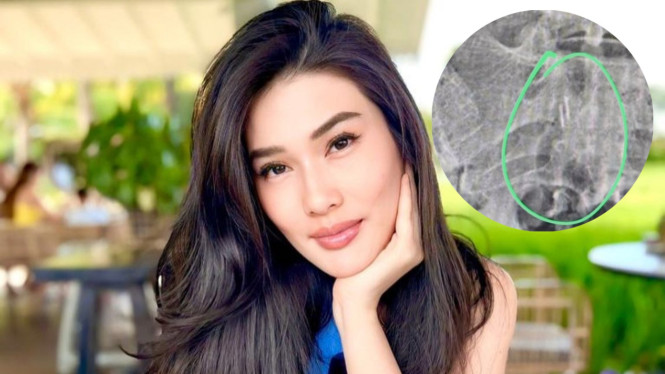 Instagram/ @steviagnecya