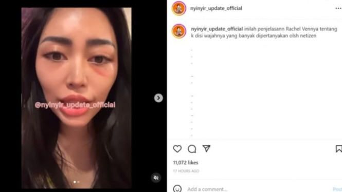 Instagram/nyinyir_update_official