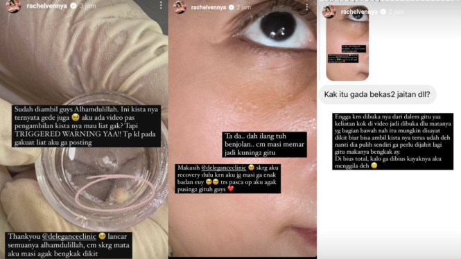 Instagram/@rachelvennya