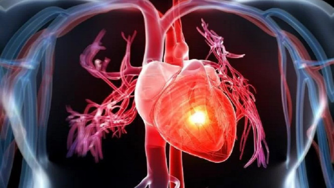 Ilustrasi - IstockPhoto