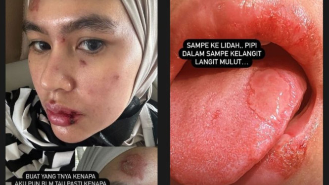 Instagram @kartikaputriworld