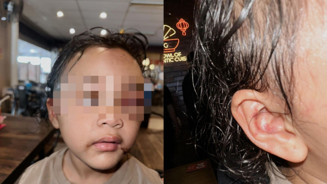 Instagram/ @emyaghnia