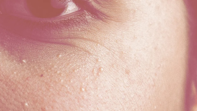 Getty Images | Allure