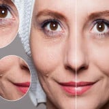 Cara Kencangkan Wajah dengan Krim Malam Alami, Hasilnya Mengejutkan Seperti Botox dalam 7 Hari