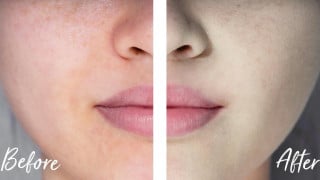 7 Cara Ampuh Merawat Wajah Kusam Agar Cerah dan Glowing Tanpa Perawatan Mahal