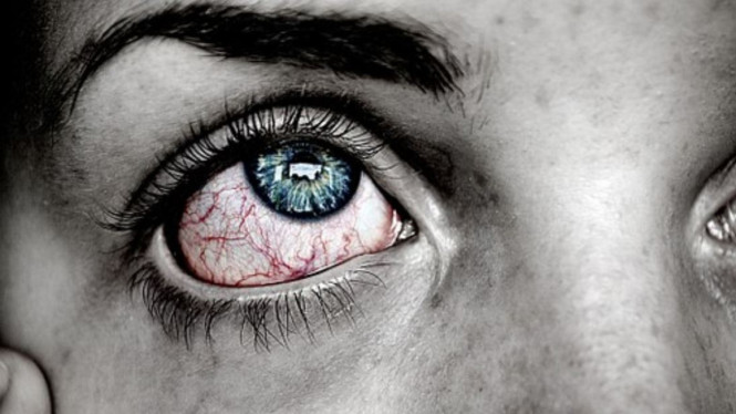 Ilustrasi mata sakit atau merah