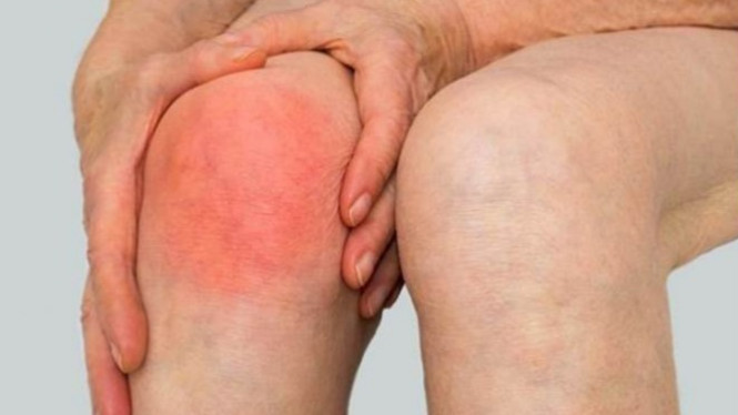 Ilustrasi nyeri sendi.