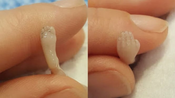 Ibu dan janinnya yang keguguran.