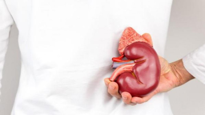 Ilustrasi penyakit batu ginjal.