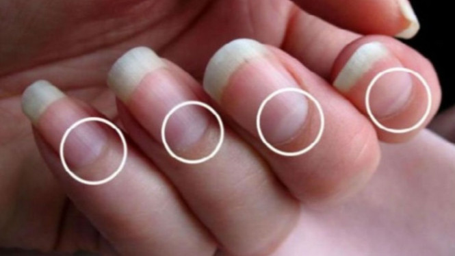 Bentuk setengah lingkaran di kuku.