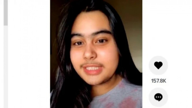 Nisya Fadhilah, wanita yang viral karena memiliki kumis.