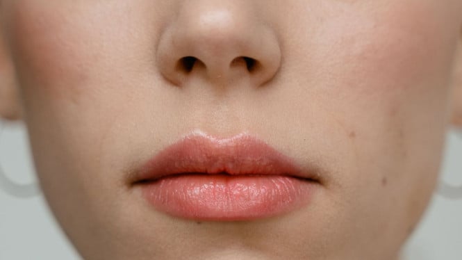 Ilustrasi kulit kering di sekitar hidung.