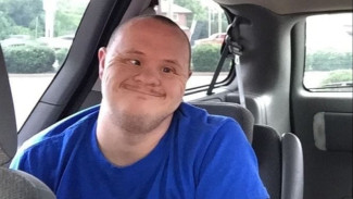 Down Syndrome? Ini Cara Perawatannya