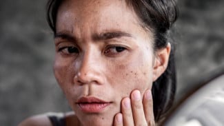 Ini Alasan Kenapa Terlalu Lama Berjemur di Bawah Sinar Matahari Malah Berbahaya