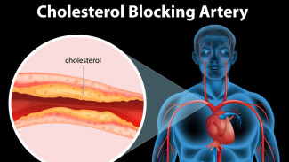 9 Cara Menurunkan Kolesterol Tinggi Tanpa Obat Paling Ampuh yang Bisa Anda Lakukan Sendiri Setiap Hari