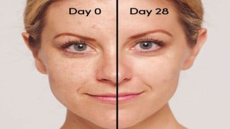 Retinol Jadi Andalan Skincare, Benarkah Bahan Ini Bisa Bikin Wajah Lebih Halus dan Awet Muda?