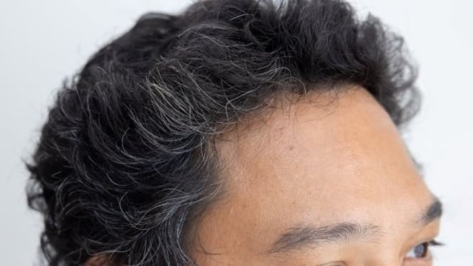 Rambut Beruban