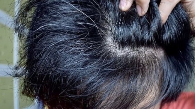 Seorang laki-laki muda yang rambutnya ber uban