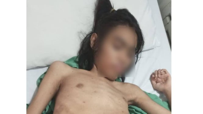 Sujuk, remaja asal Desa Dasan Tapen menderita  tumor ganas usus.