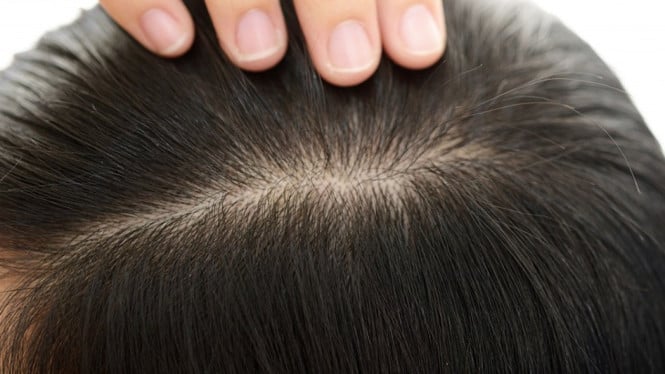 Perawatan rambut sehat