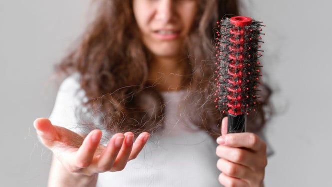 Rambut wanita yang rontok