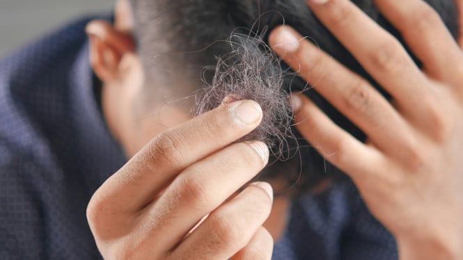 Seorang pria sedang memegang rambut rontoknya