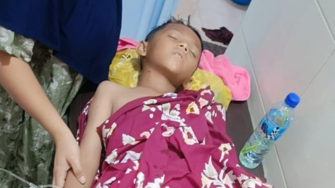 Korban Gigitan Anjing Liar di Terara
