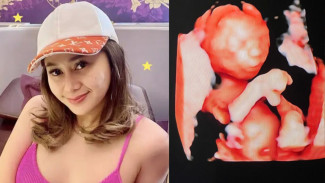 Sesuai Harapan, Denise Chariesta Berhasil Melahirkan Anaknya di Tanggal Cantik