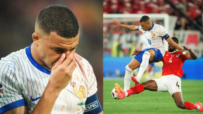 Pemain Timnas Prancis Kylian Mbappe alami patah tulang hidung.