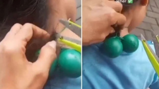 Lato-lato Memakan Korban, Terlilit ke Leher Bocah