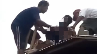 Pekerja Kuli Bangunan Asal Kebasen Banyumas Diduga Tersengat Listrik, Alami Luka Bakar