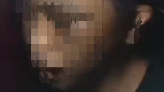 Miris! ART Asal Banyumas Diduga Alami Penganiayaan Oleh Majikan di Jakarta