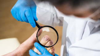 Jangan Asal cabut! Atasi Jempol Cantengan dengan Rendam Kaki di Air Khusus Ini, dr. Saddam Ismail: Kurang Lebih 15 Menit