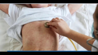 Waspada! Penyakit Campak di Banyumas Melonjak, Dinkes: Peningkatan Tidak KLB