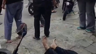 Kecelakaan di Kalipalet Banjarnegara, Sebuah Mobil Menabrak Motor Hingga Korban Luka