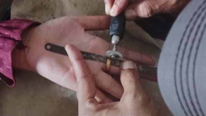 Evakuasi 4 Cincin yang Sesak di Jari Warga Kabupaten Banyumas
