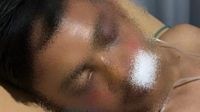 Seorang Pria Dikeroyok 10 Orang di Karanganyar Pekalongan