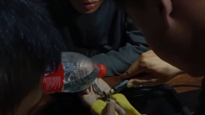 Evakuasi Pelepasan Cincin yang Sesak di Jari Warga Purwokerto