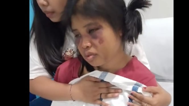 penganiayaan ART asal Sumba di Batam Tragis